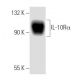 western blotting image from recommended IL-10Rα (E-6) monoclonal antibody replacement. Image 8919