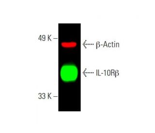 IL-10R&beta; Antibody (F-6) - Western Blotting - Image 388203 