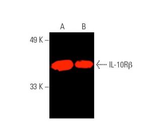 らいり catalase Antibody (H-9) | SCBT - Santa Cruz Biotechnology