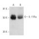 IL-11Rα Antibody (F-10) - Western Blotting - Image 357294 