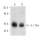 IL-11Rα Antibody (H-3) - Western Blotting - Image 357290 