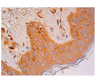 immunohistochemistry image from recommended IL-11R&alpha; (4D12) monoclonal antibody replacement. Image 315748