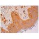 immunohistochemistry image from recommended IL-11Rα (4D12) monoclonal antibody replacement. Image 315748