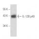 IL-12B p40 Antibody (1-1A4) - Western Blotting - Image 16291