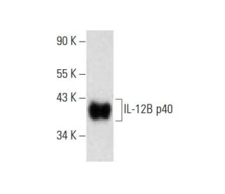 IL-12B p40 Antibody (F-10) - Western Blotting - Image 139278