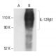 IL-12Rβ1 Antibody (A-10) - Western Blotting - Image 401876 