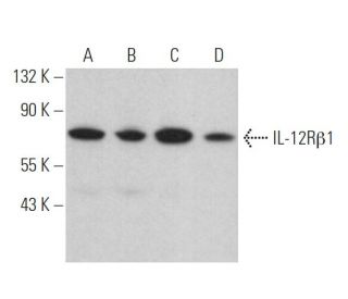 IL-12R&beta;1 Antibody (E-6) - Western Blotting - Image 364271 