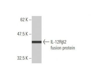 western blotting image from recommended IL-12R&beta;2 (2H6) monoclonal antibody replacement. Image 348525