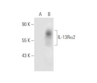 IL-13R&alpha;2 Antibody (YY-23Z) - Western Blotting - Image 59294