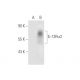 IL-13Rα2 Antibody (YY-23Z) - Western Blotting - Image 59294