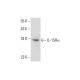 IL-15Rα Antibody (G-7) - Western Blotting - Image 132872