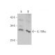 IL-15Rα Antibody (G-7) - Western Blotting - Image 346638 