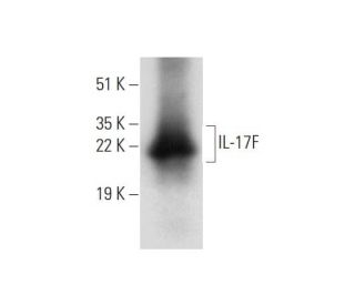 IL-17F Antibody (D-2) - Western Blotting - Image 318381