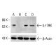 IL-17RB Antibody (TJ-5) - Western Blotting - Image 412669