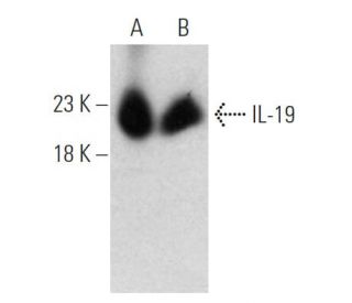 IL-19 Antibody (C1) - Western Blotting - Image 374564