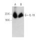 IL-19 Antibody (C1) - Western Blotting - Image 374564