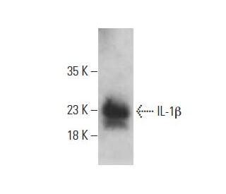 BWT Cillit Immuno 152 - Merkapt Zrt.