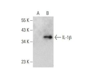 IL-1 beta/IL1B Antibody (F-5) - Western Blotting - Image 352602
