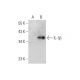 IL-1 beta/IL1B Antibody (F-5) - Western Blotting - Image 352602