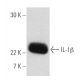 This polyclonal antibody has been discontinued. See our recommended <a href="il-1beta-antibody-b122">IL-1 beta/IL1B (B122)</a> monoclonal antibody (sample data shown). western blotting image from recommended IL-1 beta/IL1B (B122) monoclonal antibody replacement. Image 2609