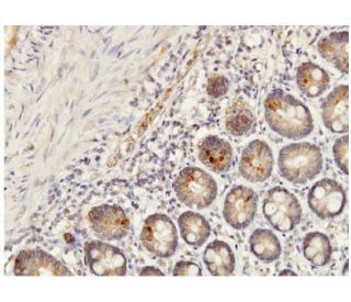 IL-1F7 Antibody (6A6) - Immunohistochemistry - Image 351774 