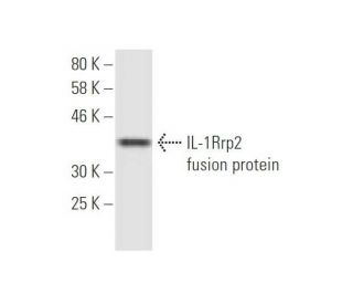 IL-1Rrp2 Antibody (5G5) - Western Blotting - Image 348977