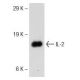 western blotting image from recommended IL-2 (F-5) monoclonal antibody replacement. Image 145733