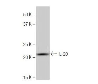IL-20 Antibody (PL-C21) - Western Blotting - Image 64974 