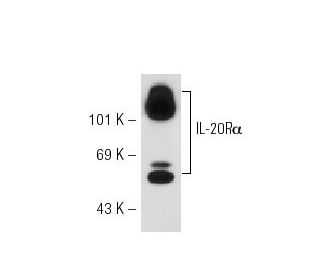 IL-20R&alpha; Antibody (EE09) - Western Blotting - Image 54896 