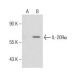 IL-20Rα Antibody (EE09) - Western Blotting - Image 160811