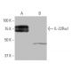 IL-22Rα1 Antibody (3-RE40) - Western Blotting - Image 64976 