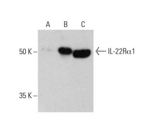 IL-22R&alpha;1 Antibody (3-RE40) - Western Blotting - Image 384292 