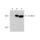 IL-22Rα1 Antibody (3-RE40) - Western Blotting - Image 384292 
