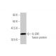 IL-23R Antibody (3D7) - Western Blotting - Image 350342