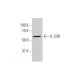 IL-23R Antibody (3D7) - Western Blotting - Image 352232 