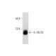 This polyclonal antibody has been discontinued. See our recommended <a href="il-28-29-antibody-h-1">IL-28/29 (H-1)</a> monoclonal antibody (sample data shown). western blotting image from recommended IL-28/29 (H-1) monoclonal antibody replacement. Image 145500