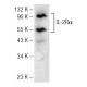 IL-2Rα Antibody (C-11) - Western Blotting - Image 141770 
