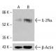 IL-2Rα Antibody (C-9) - Western Blotting - Image 415236