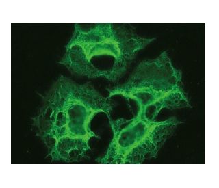 IL-2R&alpha; Antibody (G-7) - Immunofluorescence - Image 149840 