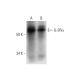 Este anticorpo policlonal foi descontinuado. Consulta o nosso anticorpo monoclonal <a href="il-2ralpha-antibody-c-9">IL-2Rα (C-9)</a> recomendado (dados de amostra apresentados). western blotting image from recommended IL-2Rα (C-9) monoclonal antibody replacement. Image 294597