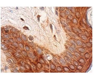 immunohistochemistry image from recommended IL-2R&beta; (C-2) monoclonal antibody replacement. Image 281920