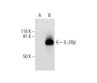 IL-2R&beta; Antibody (G-1) - Western Blotting - Image 292064