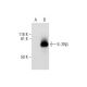 IL-2Rβ Antibody (G-1) - Western Blotting - Image 292064