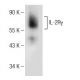 IL-2Rγ Antibody (G-3) - Western Blotting - Image 148981
