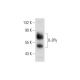 Cet anticorps polyclonal n'est plus commercialisé. Voir l'anticorps monoclonal <a href="il-2rgamma-antibody-a-10">IL-2Rγ (A-10)</a> que nous recommandons (données d'échantillonnage indiquées). western blotting image from recommended IL-2Rγ (A-10) monoclonal antibody replacement. Image 129394