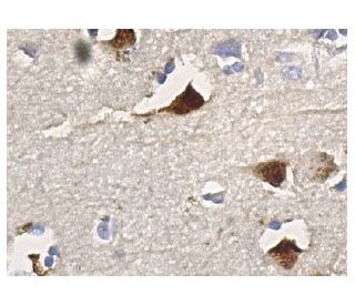 IL-3/IL-5/GM-CSFR&beta; Antibody (1C1) - Immunohistochemistry - Image 156518 