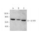IL-31R Antibody (A-12) - Western Blotting - Image 348627