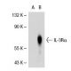 IL-3Rα Antibody (6H6) - Western Blotting - Image 31781 