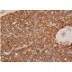 IL-3Rα Antibody (C-5) - Immunohistochemistry - Image 368826