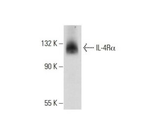 IL-4R&alpha; Antibody (D-2) - Western Blotting - Image 73167The Double Nickase Plasmid features a U6 promoter for sgRNA expression, a 20 nt targeting sequence, and a gRNA scaffold to guide Cas9n. It includes a CBh promoter for Cas9n (D10A) and puromycin resistance, GFP for transfection verification, and nuclear localization signals (NLS). The 2A peptide allows co-expression of Cas9n and Puro from a single promoter, enabling precise genome editing with reduced off-target effects. 